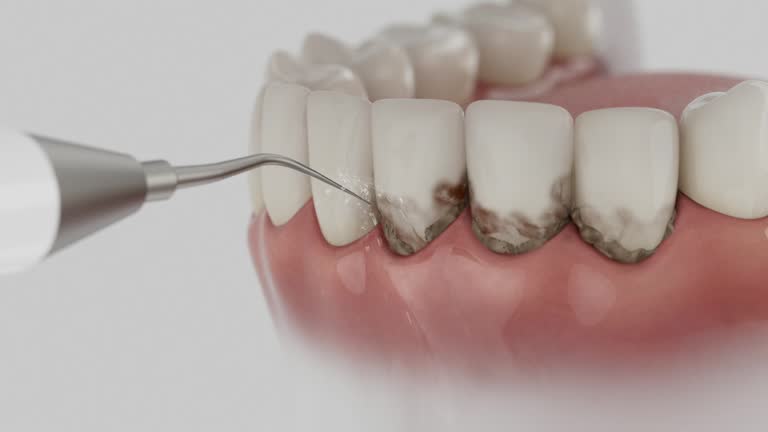 Trusted Tooth Extraction service in Shepherd, MI - Dentist Open Now
